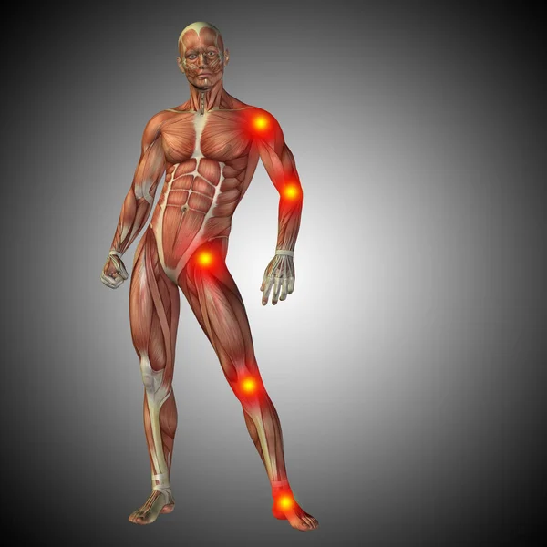 Anatomía del cuerpo humano con inflamación — Foto de Stock
