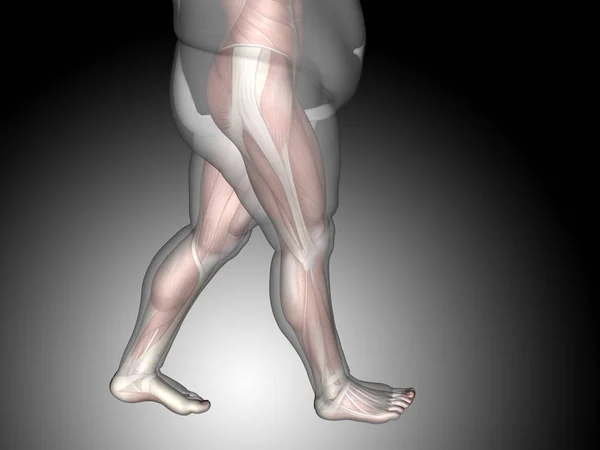 Εικονογράφηση του υπέρβαρου ανθρώπινου σώματος — Φωτογραφία Αρχείου