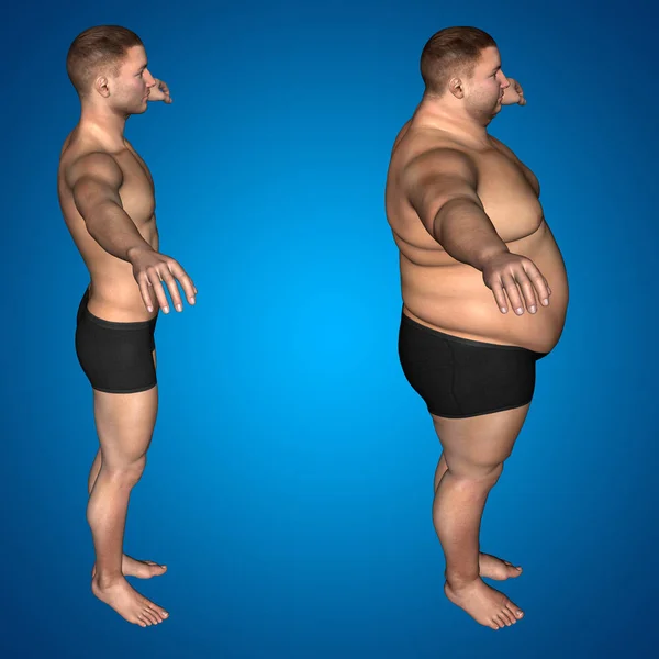 Illustration of overweight human body — Stock Photo, Image