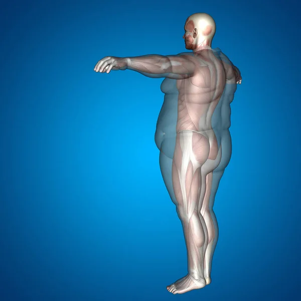 Illustrazione del corpo umano sovrappeso — Foto Stock