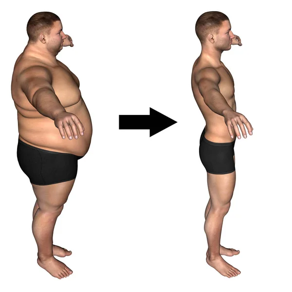 Illustration av överviktiga människokroppen — Stockfoto