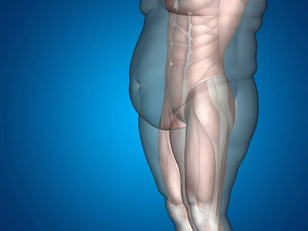 Ilustración del cuerpo humano con sobrepeso — Foto de Stock