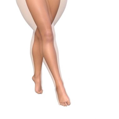 vs ince bacakları kilolu