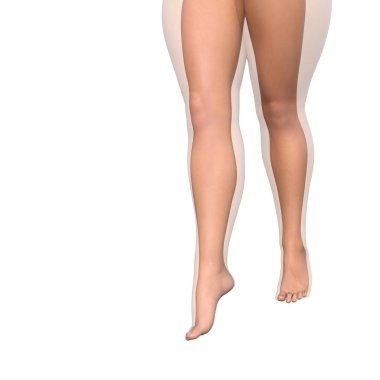 kadın bacakları, wheight kaybı kavramı