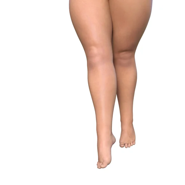 Overweight pernas femininas — Fotografia de Stock