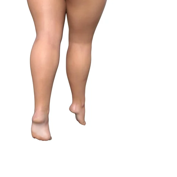 Overweight female legs — Stock Photo, Image