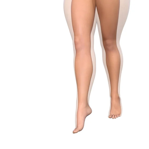 Pernas femininas, conceito de perda de peso — Fotografia de Stock
