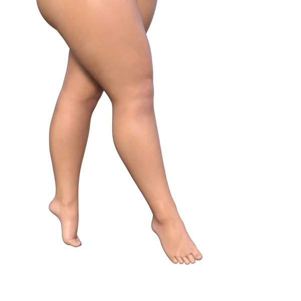 Kilolu kadın bacakları — Stok fotoğraf