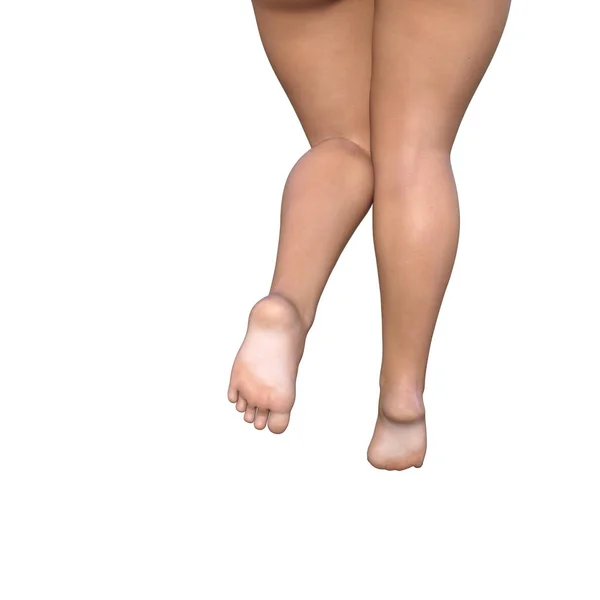 Overweight pernas femininas — Fotografia de Stock
