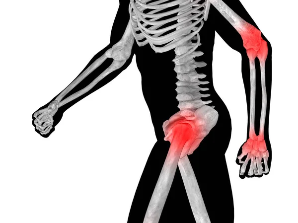 Corpo anatomico umano con dolore — Foto Stock