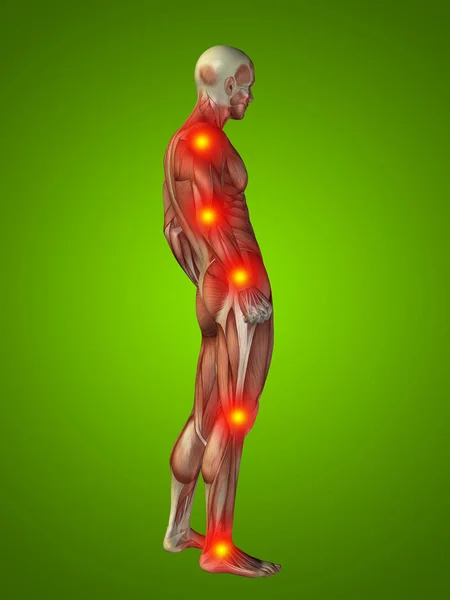 Human body anatomy with pain signs — Stock Photo, Image