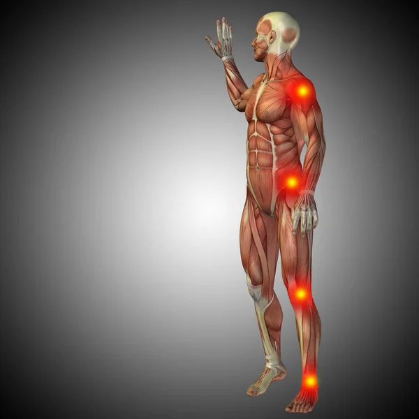 Anatomía del cuerpo humano con signos de dolor — Foto de Stock