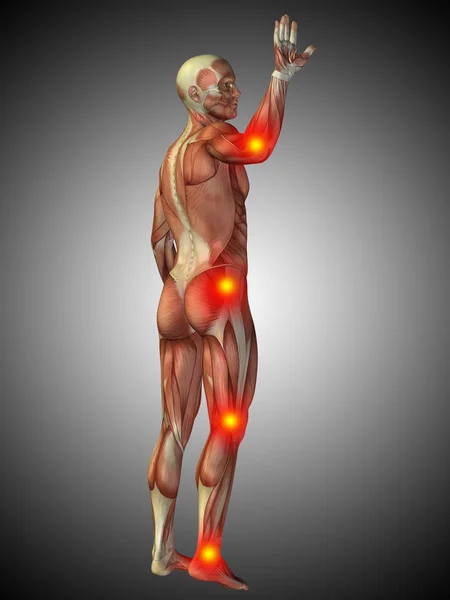 Human body anatomy with pain signs — Stock Photo, Image