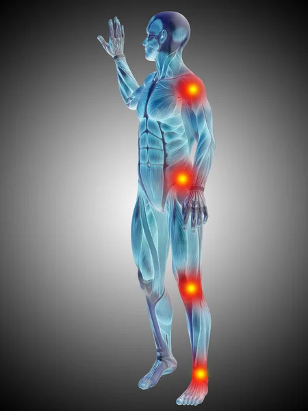 Human body anatomy with pain signs — Stock Photo, Image