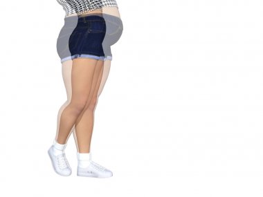 obez kadın vs slim fit sağlıklı vücut 