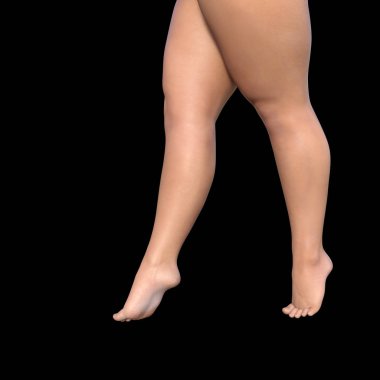 şişko kadın bacakları