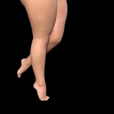 şişko kadın bacakları