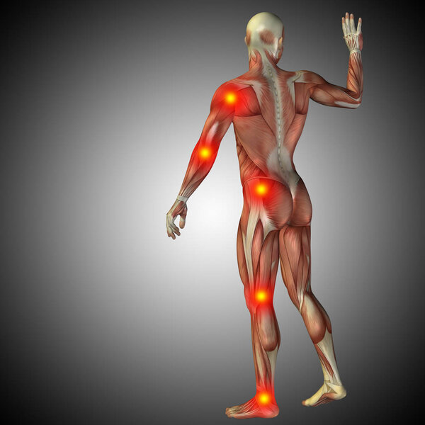 анатомия человеческого тела с болевыми признаками
