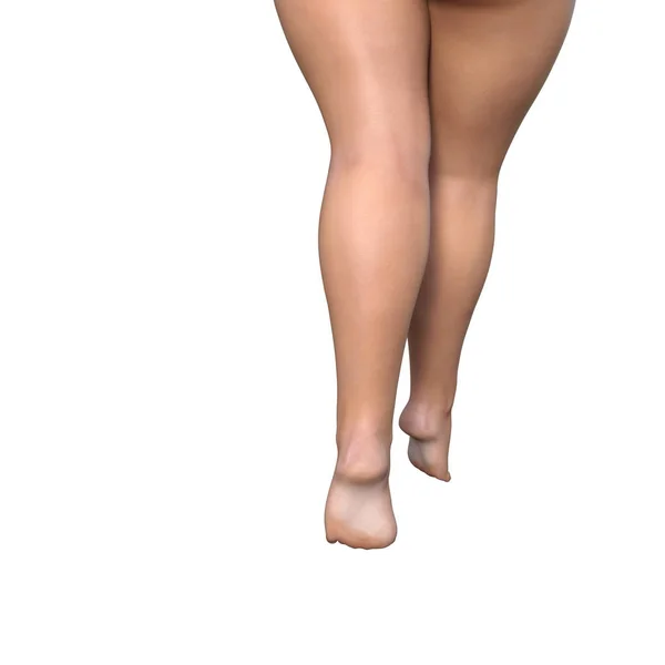 Şişko kadın bacakları — Stok fotoğraf