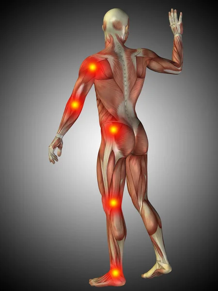 Mänskliga kroppen anatomi med smärta tecken — Stockfoto