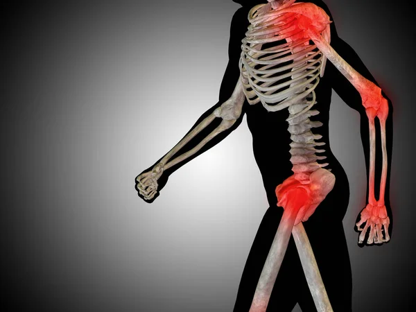 Modelo de anatomía humana corriendo — Foto de Stock