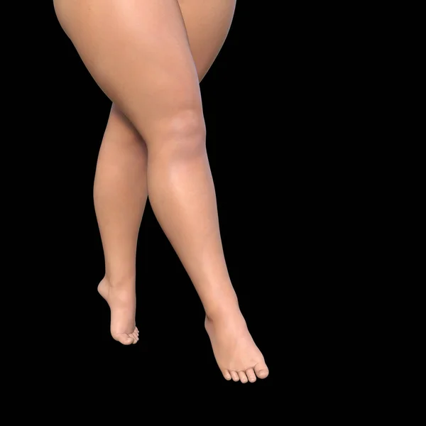 Fett kvinna ben — Stockfoto