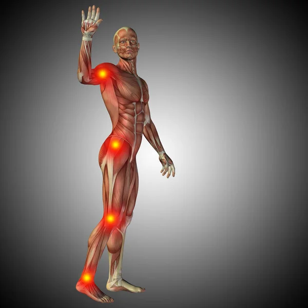 Anatomía del cuerpo humano con signos de dolor — Foto de Stock