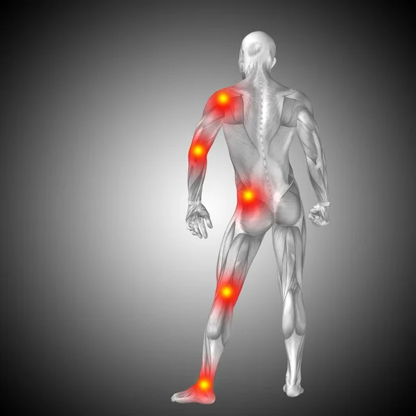 human body anatomy with pain signs