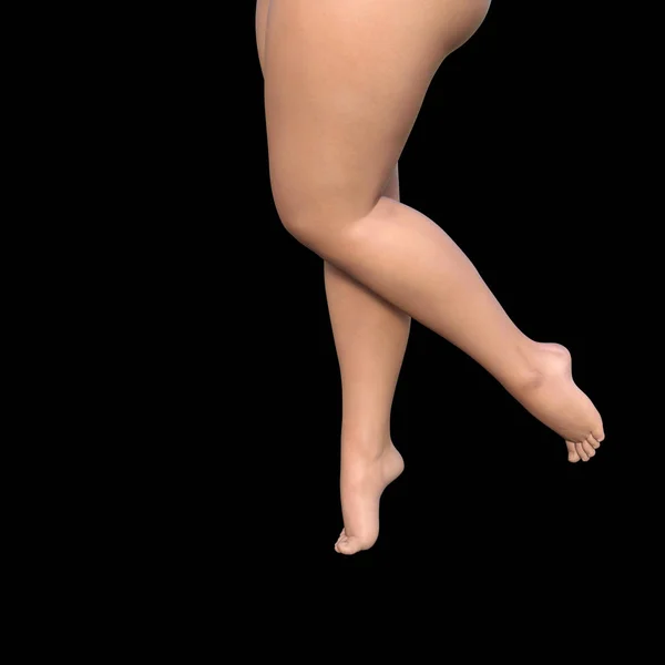 Tlustý ženský nohy — Stock fotografie