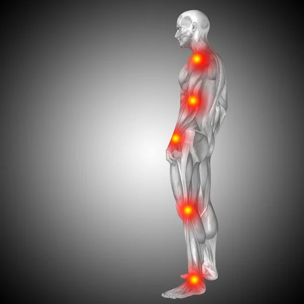 Anatomia do corpo humano com sinais de dor — Fotografia de Stock