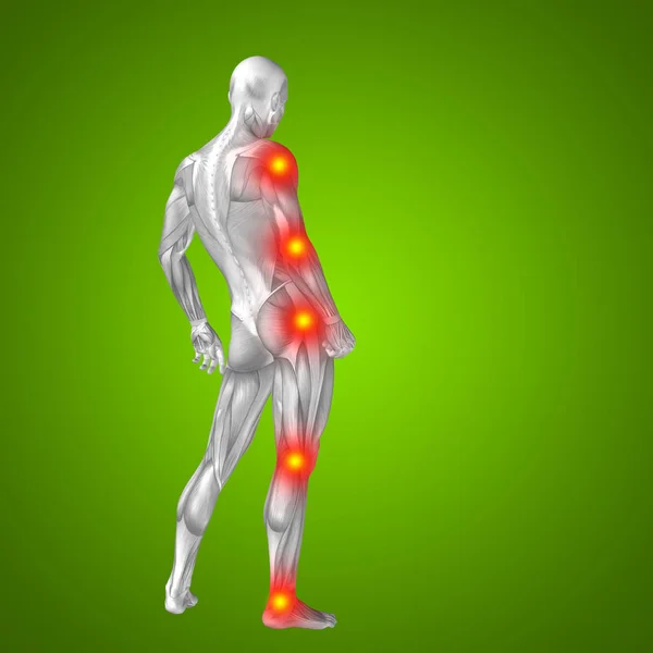 Anatomia do corpo humano com sinais de dor — Fotografia de Stock