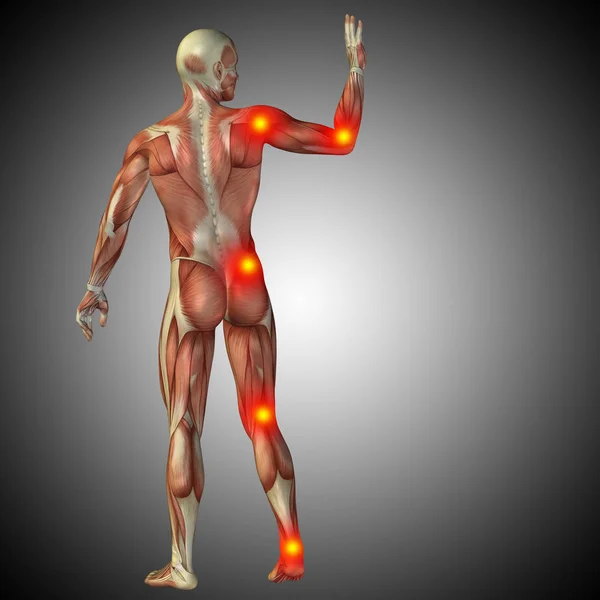Anatomía del cuerpo humano con signos de dolor —  Fotos de Stock