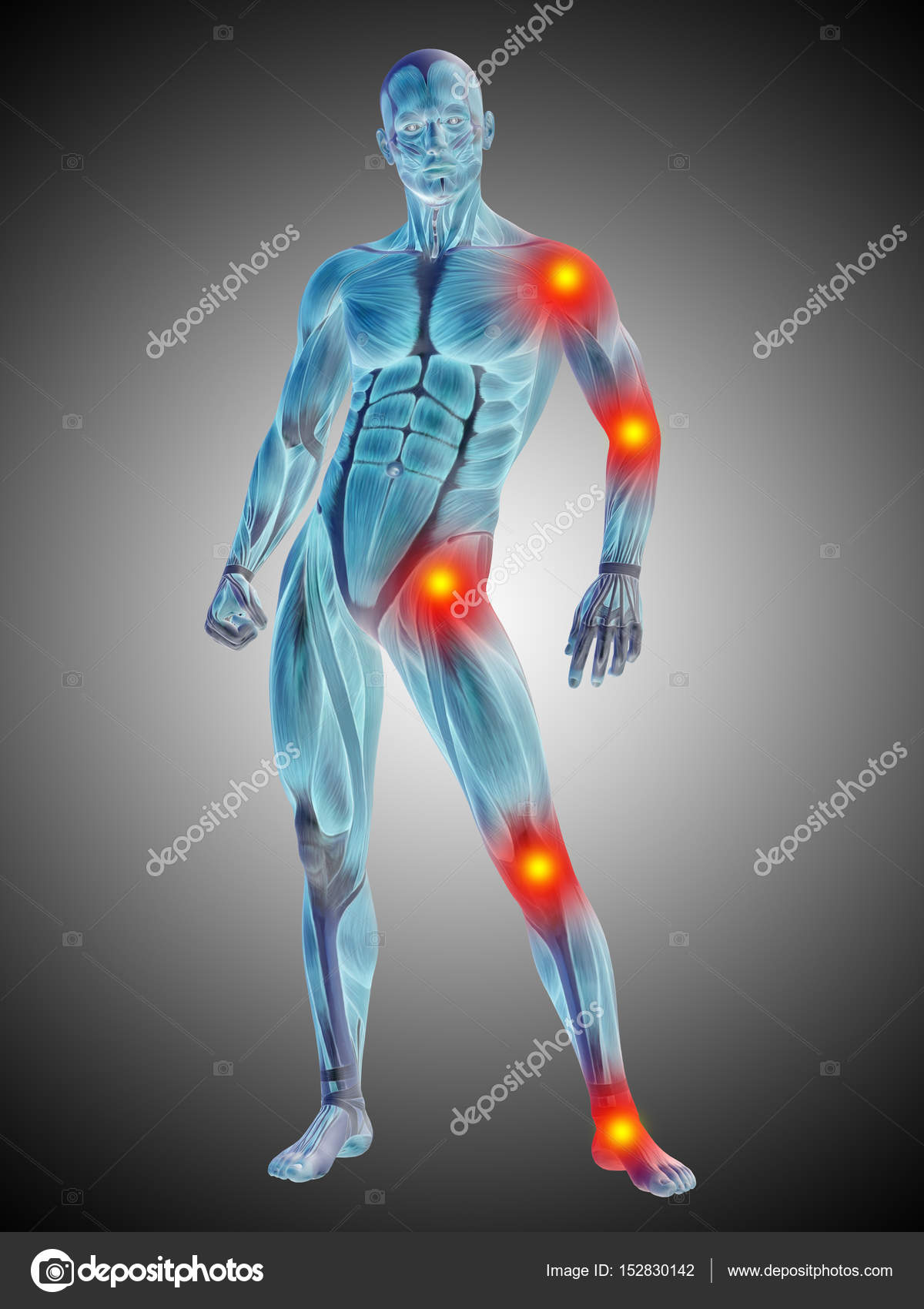 [DIAGRAM] Printable Human Body Diagram Injury