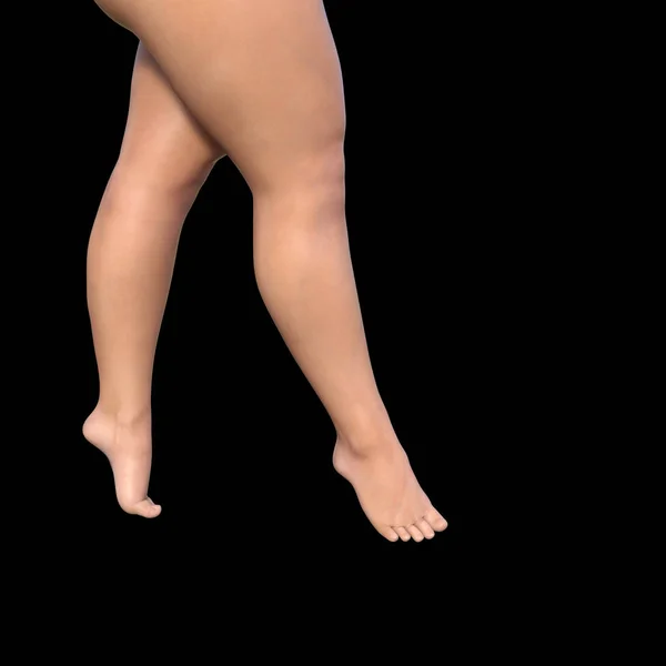 Fat female legs — Stock Photo, Image