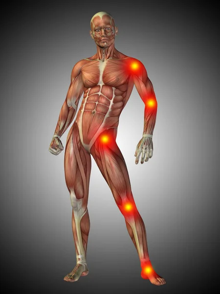 Mänskliga kroppen anatomi med inflammation tecken — Stockfoto