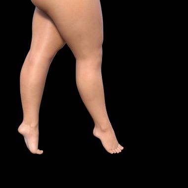 Selülit kadın bacakları