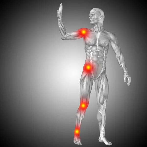 Anatomia do corpo humano com sinais de inflamação — Fotografia de Stock