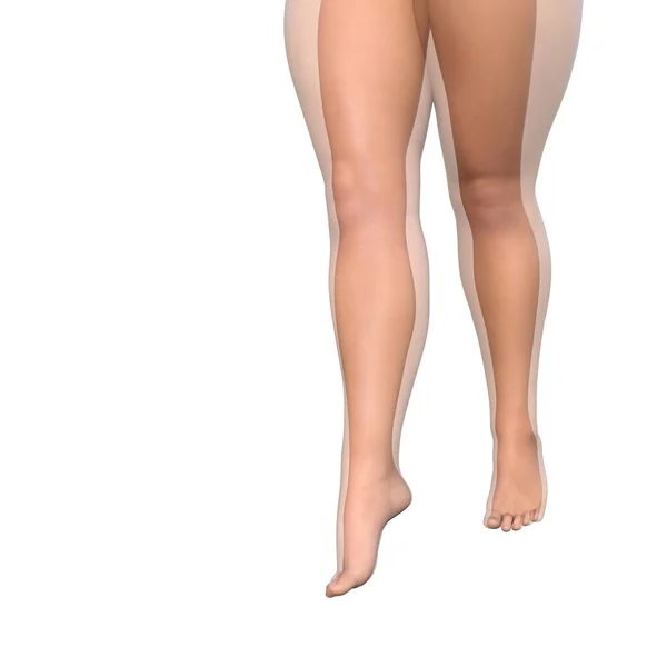 Tlustou přívažek vs štíhlé ženské nohy — Stock fotografie