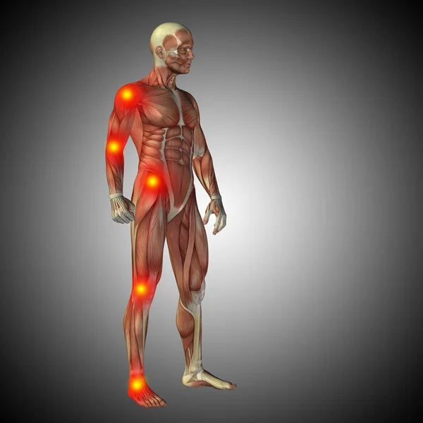 Human body anatomy with inflammation signs — Stock Photo, Image