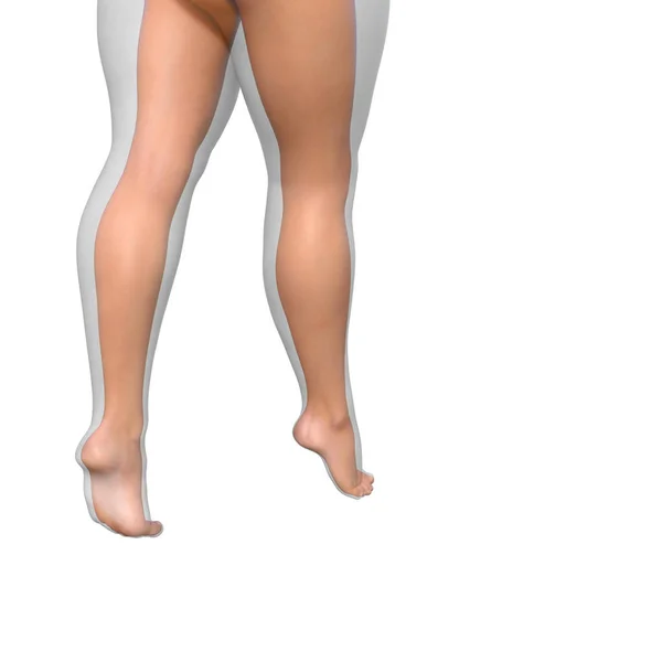 Fet övervikt vs smala kvinnliga ben — Stockfoto