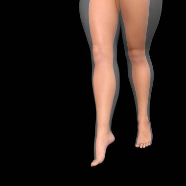 kilolu kadın bacak vs ince uygun diyet