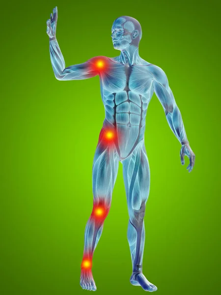 Anatomía humana cuerpo con dolor articular — Foto de Stock