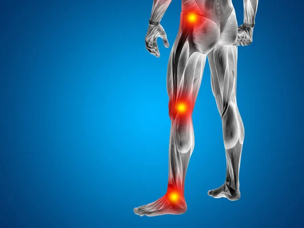 Anatomy lower body with articular pain — Stock Photo, Image