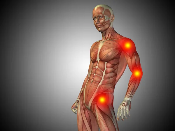 Lidské anatomie těla s kloubní bolest — Stock fotografie