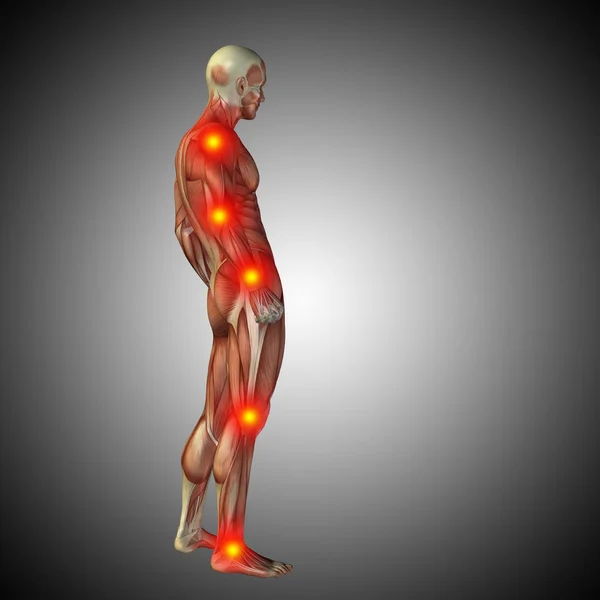 Human anatomy body with pain and inflammation — Stock Photo, Image