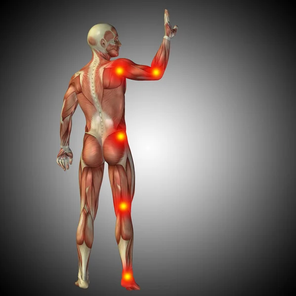 Cuerpo de anatomía humana con dolor e inflamación — Foto de Stock