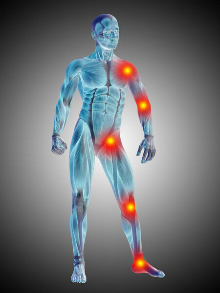  тело анатомии человека с болью и воспалением
