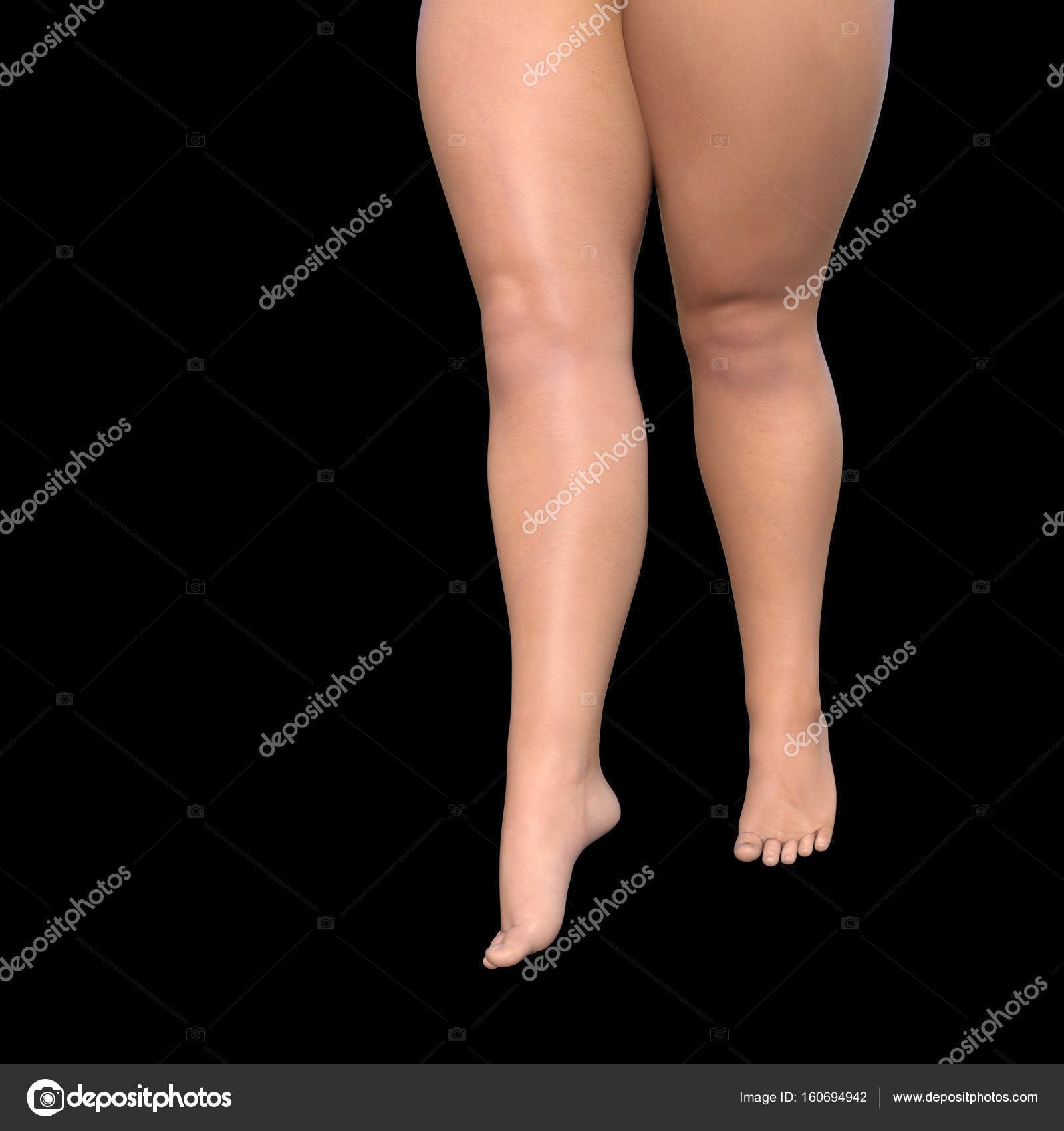 Pics Cellulite Overweight Cellulite Female Legs Stock Photo