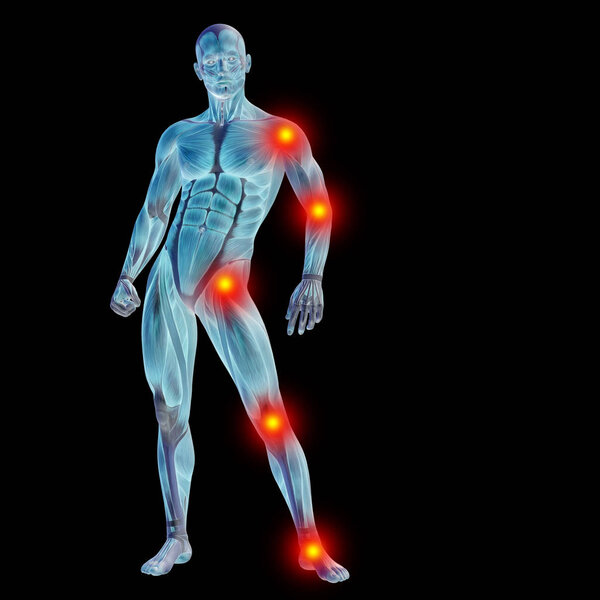 Человеческое анатомическое тело с болью
