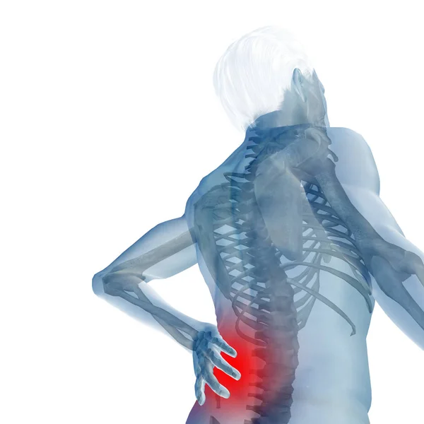 Anatomía del hombre con dolor de espalda — Foto de Stock